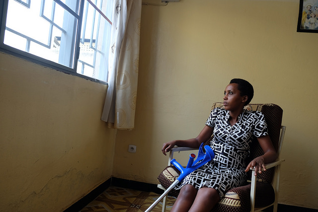 Caritas helps Daphne, 23, pay for medical treatment for her badly injured leg. Photo by Nicholson/Caritas