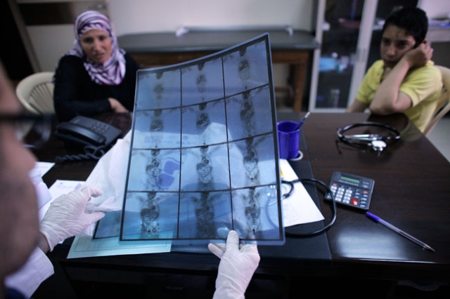 Docteur Rouchdi El Hajj (L), pédiatre, regarde X-ray de Mohammed (R) souffrant d'un cancer à St Michel médico-social Centre, soutenu par Caritas, le 20 Juin 2014, au Sed El Baouchrieh à Beyrouth. Crédit: Matthieu Alexandre / Caritas