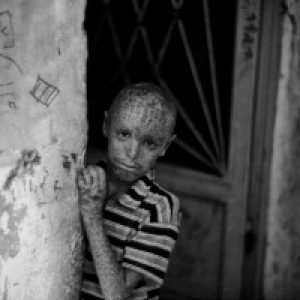 La tragédie de la Syrie en noir et blanc